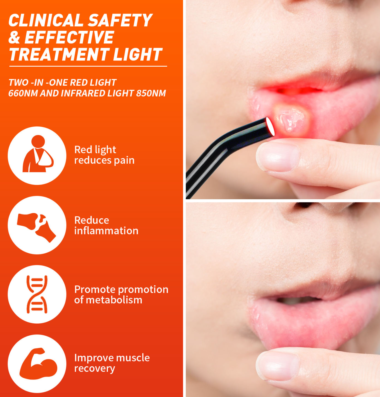 RED LIGHT THERAPY WAND